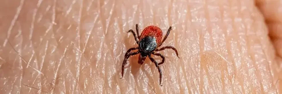 tick bites